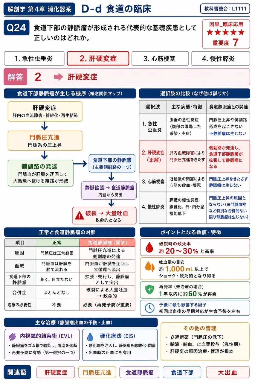 食道裂孔ヘルニアが逆流性食道炎(GERD)の原因となる主要機序として正しいのはどれか。 解説図