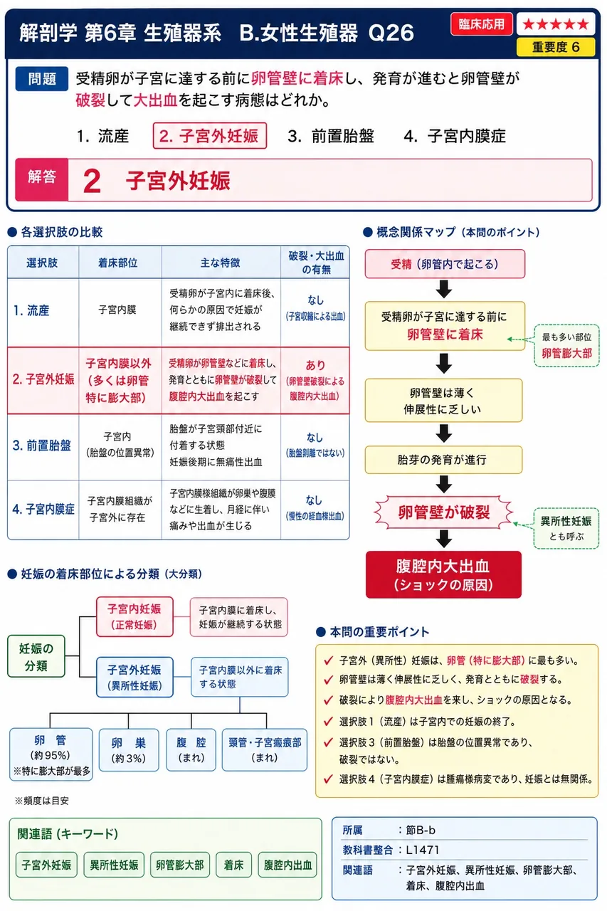 受精卵が子宮に達する前に卵管壁に着床し、発育が進むと卵管壁が破裂して大出血を起こす病態はどれか。 解説図
