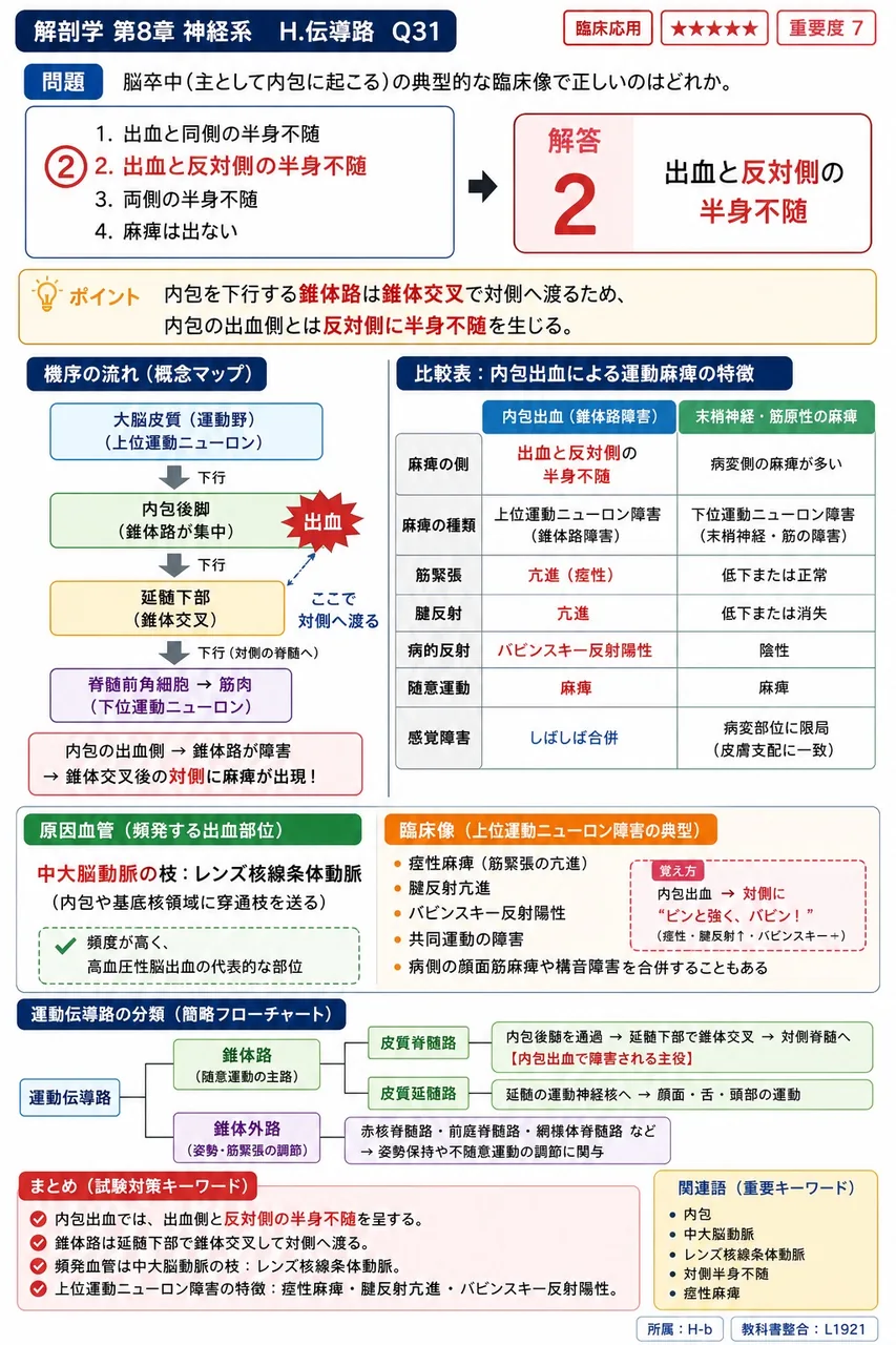 脳卒中(主として内包に起こる)の典型的な臨床像で正しいのはどれか。 解説図