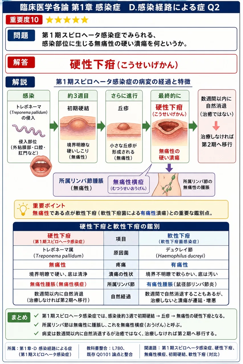 第1期梅毒でみられる、感染部位に生じる無痛性の硬い潰瘍を何というか。 解説図