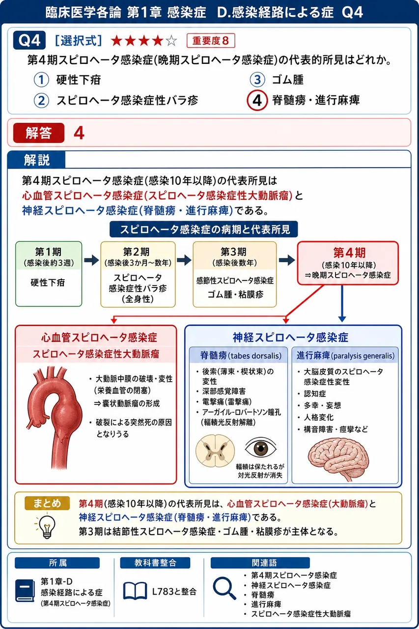 第4期梅毒(晩期梅毒)の代表的所見はどれか。 解説図