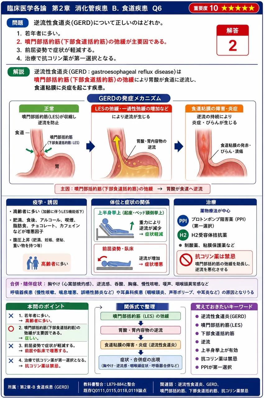 逆流性食道炎(GERD)について正しいのはどれか。 解説図