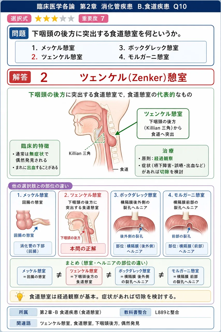 下咽頭の後方に突出する食道憩室を何というか。 解説図