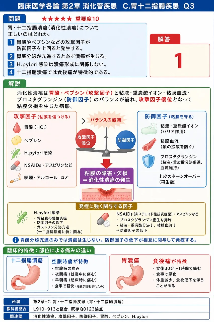 胃・十二指腸潰瘍(消化性潰瘍)について正しいのはどれか。 解説図