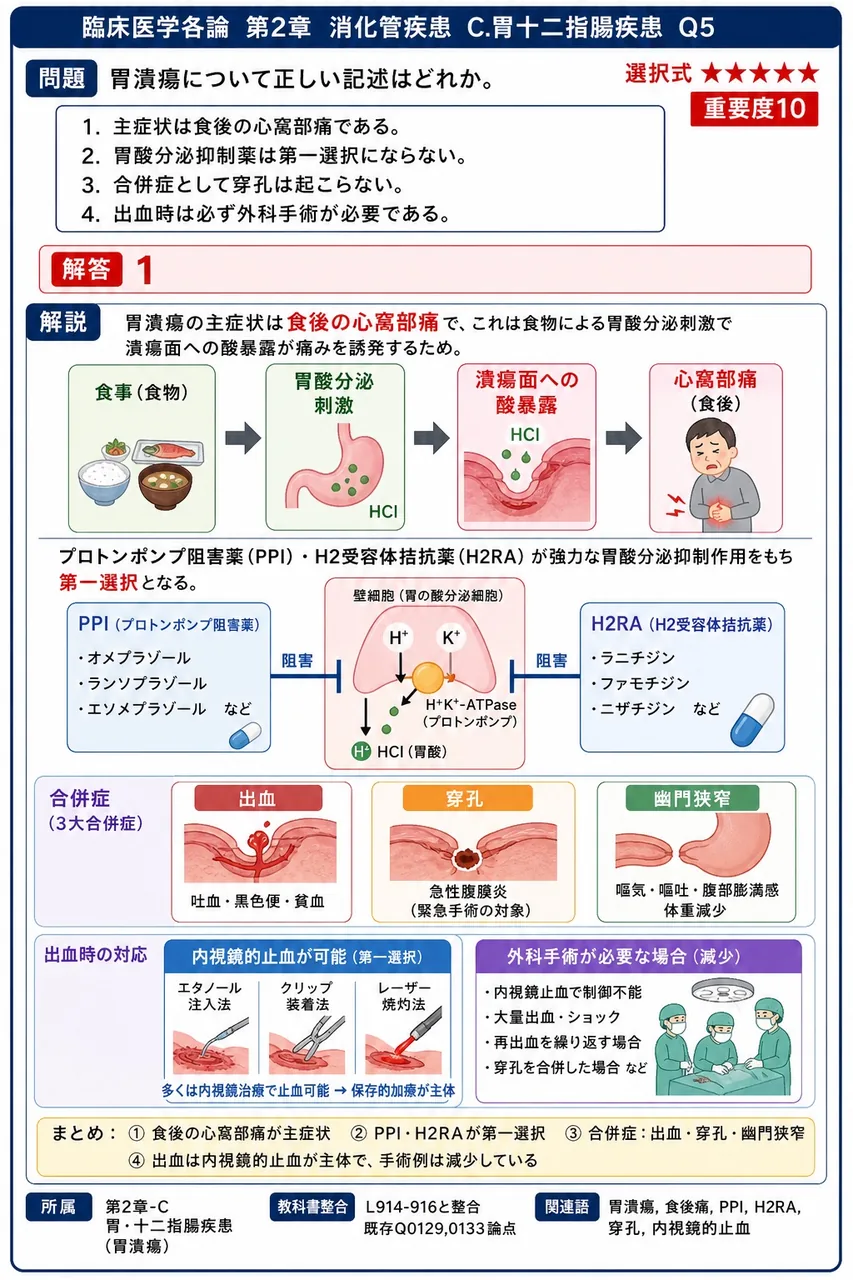 胃潰瘍について正しい記述はどれか。 解説図