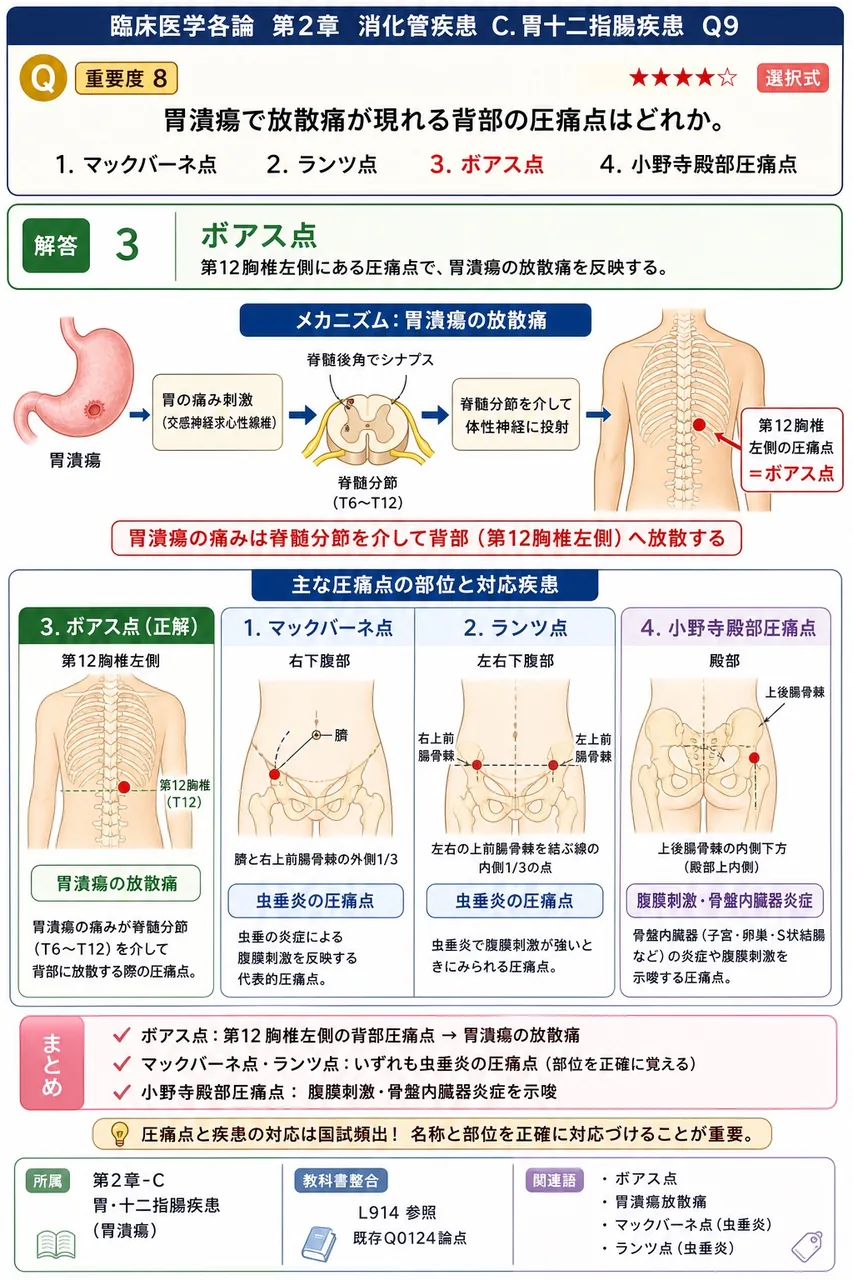 胃潰瘍で放散痛が現れる背部の圧痛点はどれか。 解説図