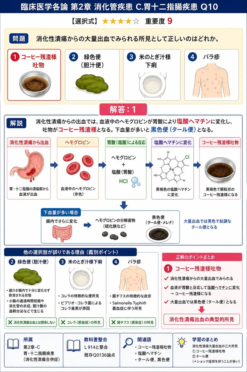 消化性潰瘍からの大量出血でみられる所見として正しいのはどれか。 解説図