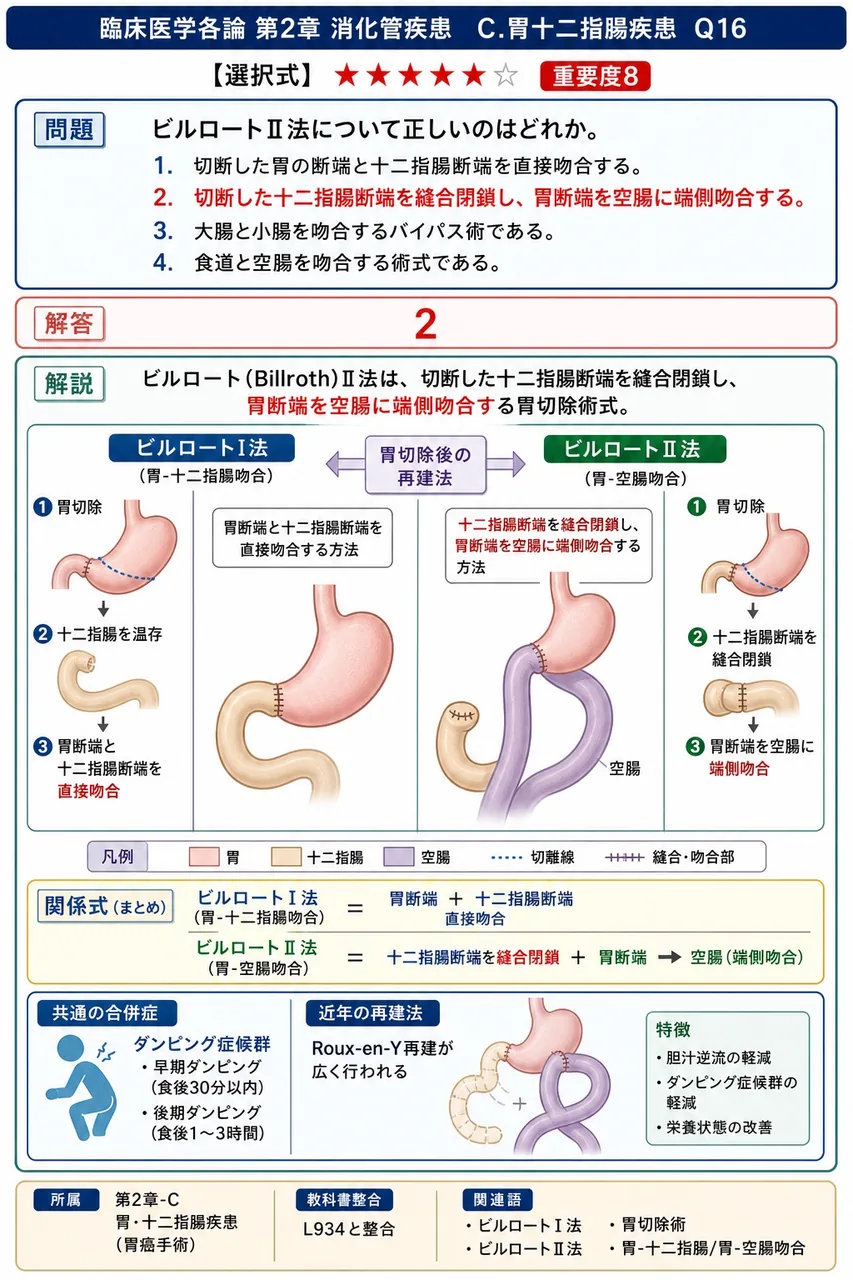 ビルロートII法について正しいのはどれか。 解説図