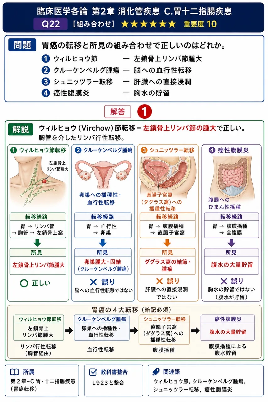 胃癌の転移と所見の組み合わせで正しいのはどれか。 解説図