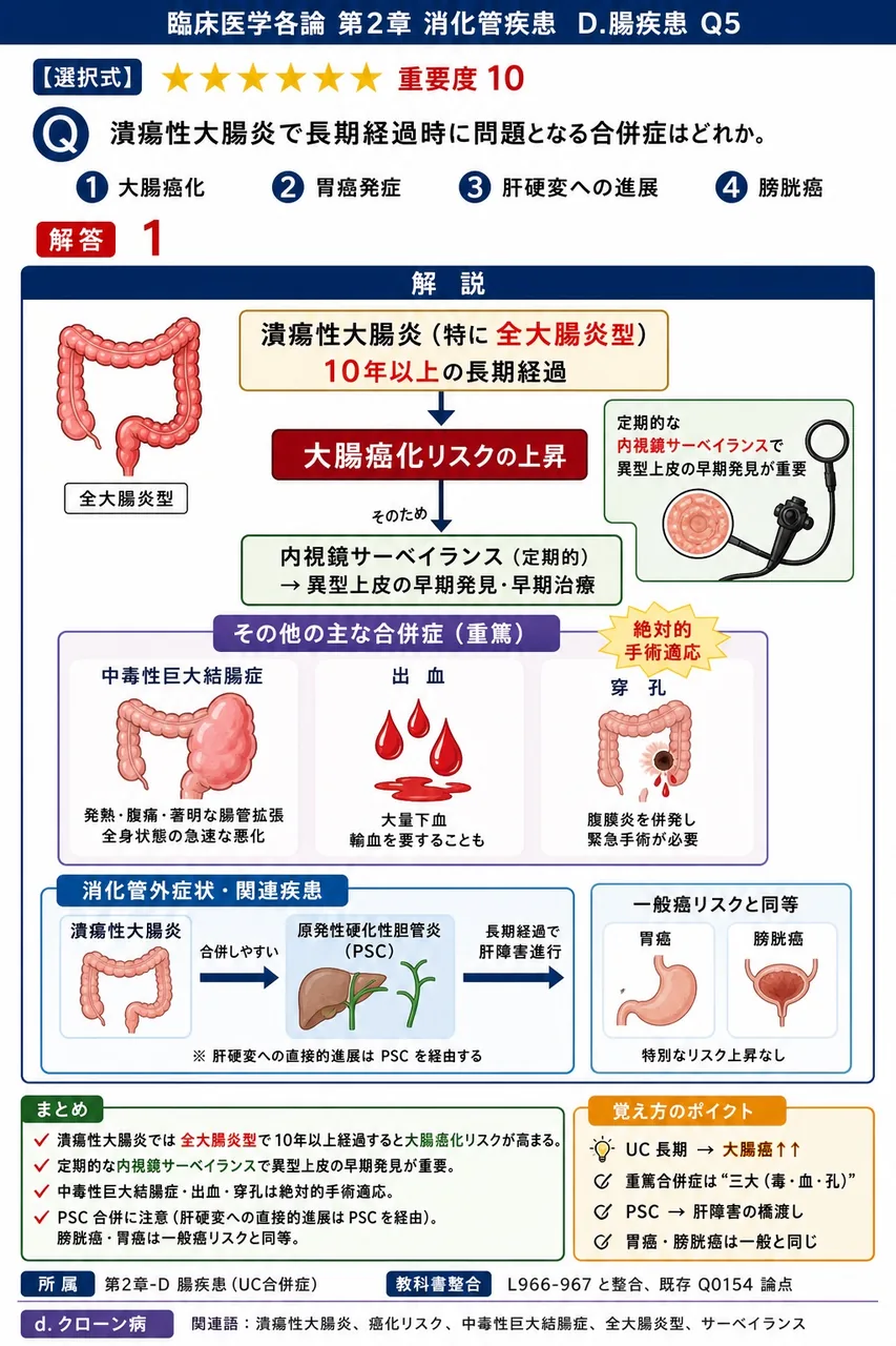潰瘍性大腸炎で長期経過時に問題となる合併症はどれか。 解説図
