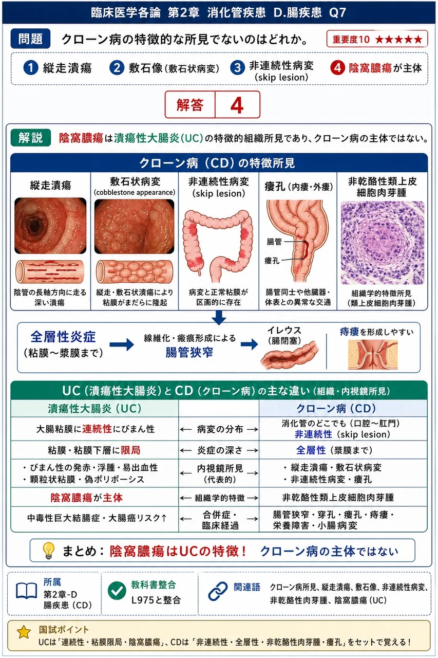 クローン病の特徴的な所見でないのはどれか。 解説図
