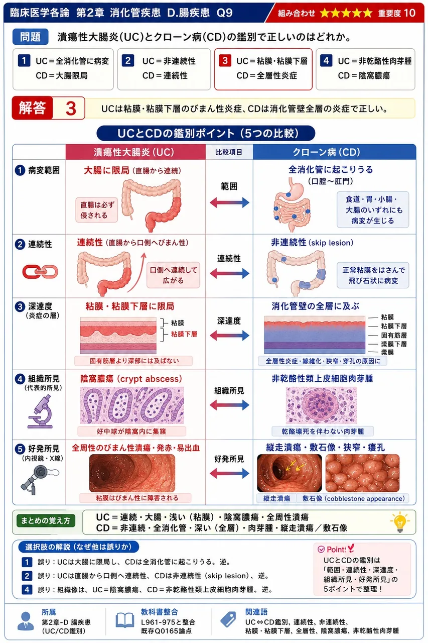 潰瘍性大腸炎(UC)とクローン病(CD)の鑑別で正しいのはどれか。 解説図