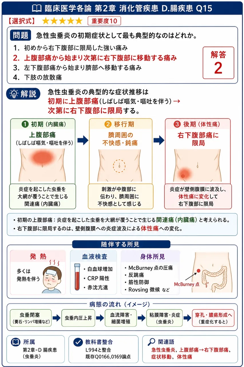 急性虫垂炎の初期症状として最も典型的なのはどれか。 解説図