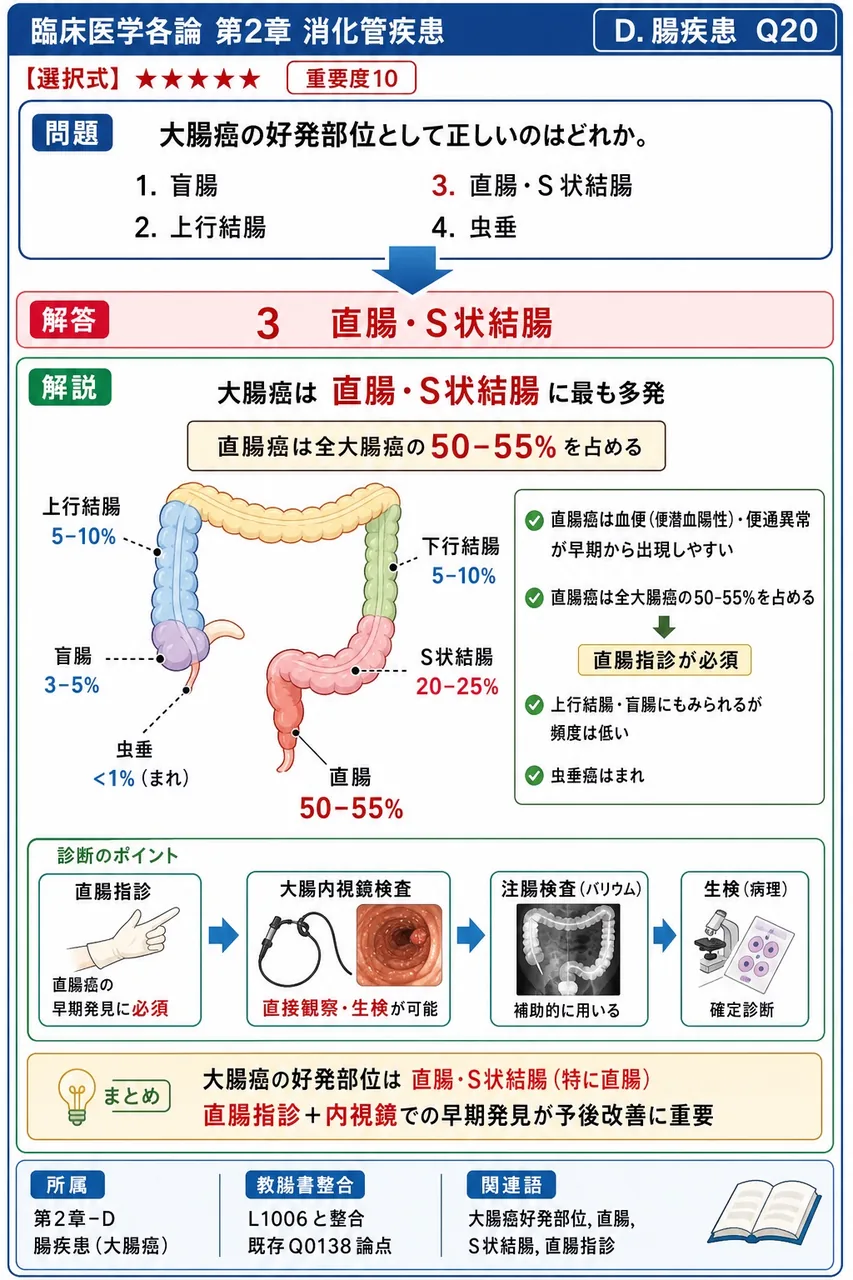 大腸癌の好発部位として正しいのはどれか。 解説図