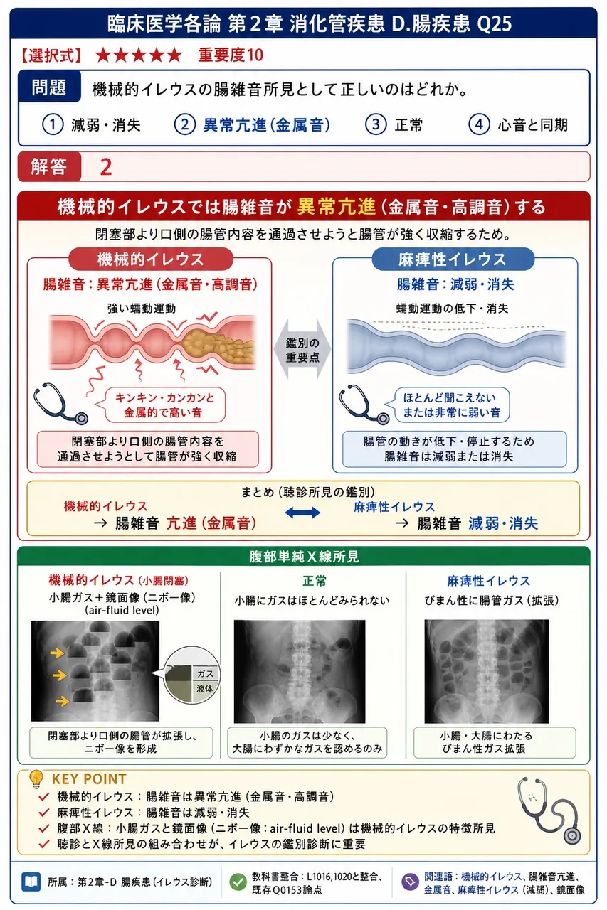 機械的イレウスの腸雑音所見として正しいのはどれか。 解説図