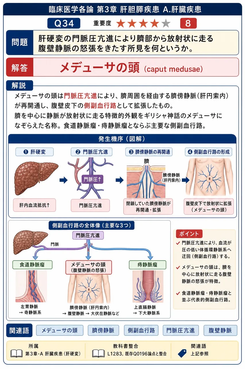 肝硬変の門脈圧亢進により臍部から放射状に走る腹壁静脈の怒張をきたす所見を何というか。 解説図