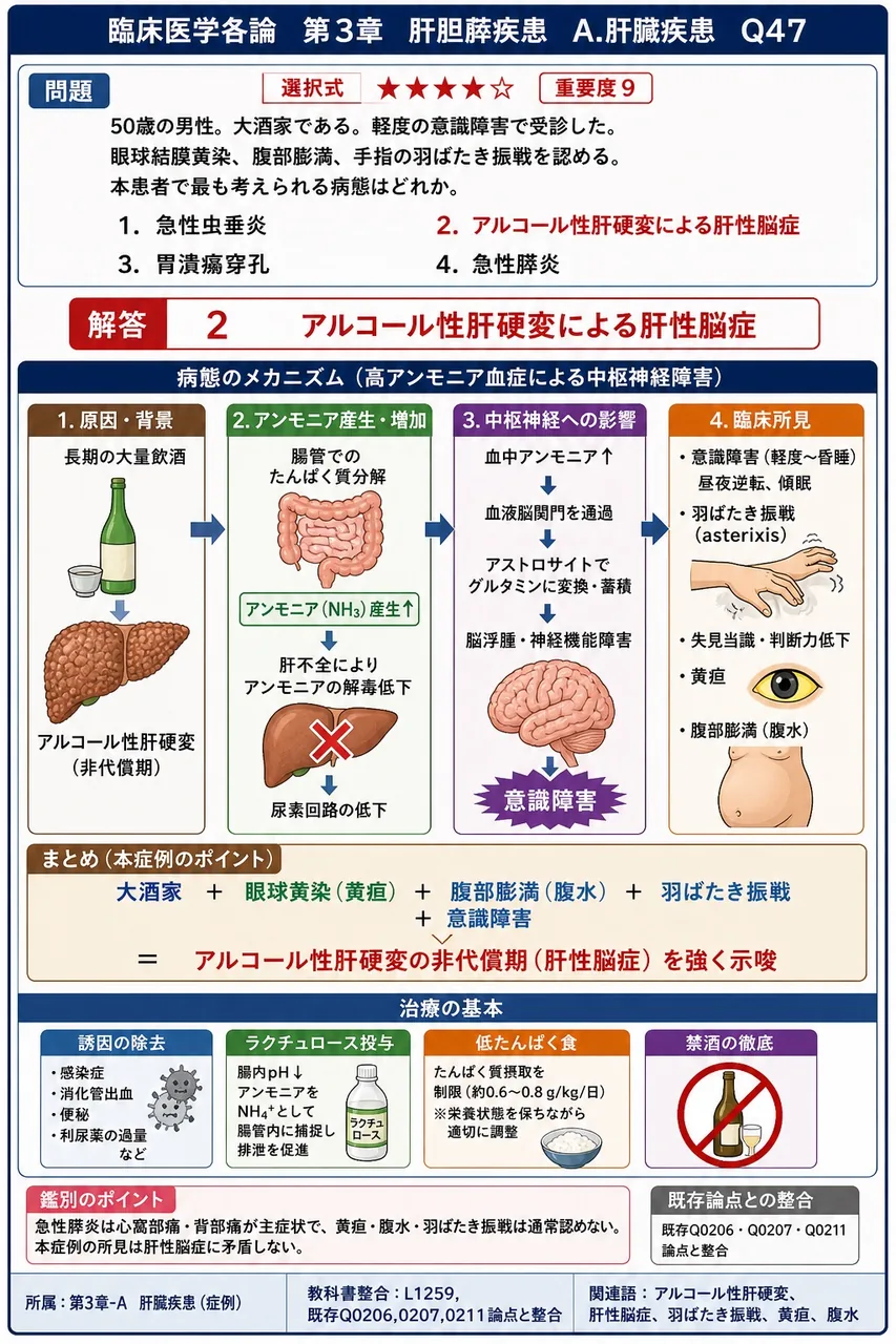 「50歳の男性。大酒家である。軽度の意識障害で受診した。眼球結膜黄染、腹部膨満、手指の羽ばたき振戦を認める。」本患者で最も考えられる病態はどれか。 解説図