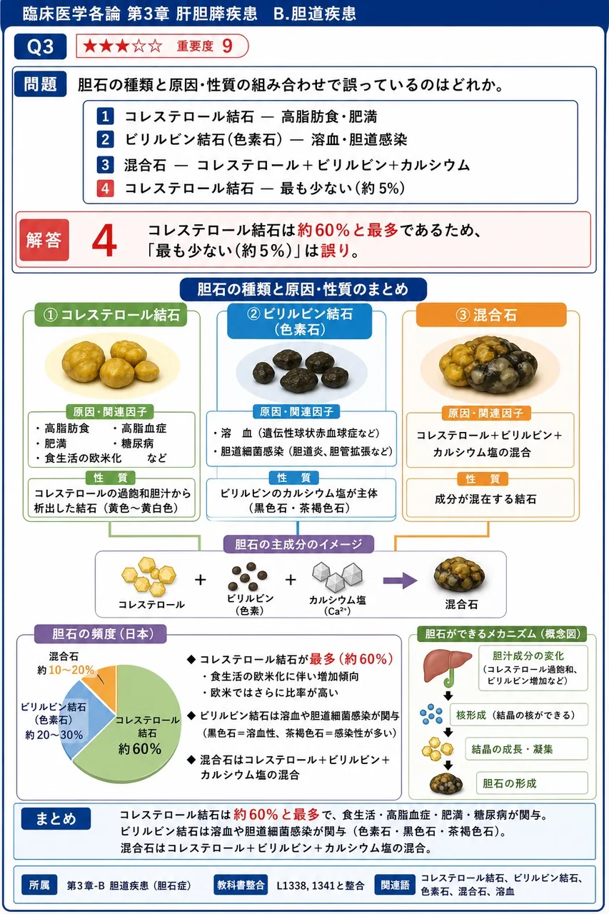胆石の種類と原因・性質の組み合わせで誤っているのはどれか。 解説図