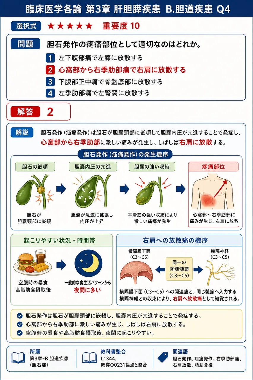 胆石発作の疼痛部位として適切なのはどれか。 解説図