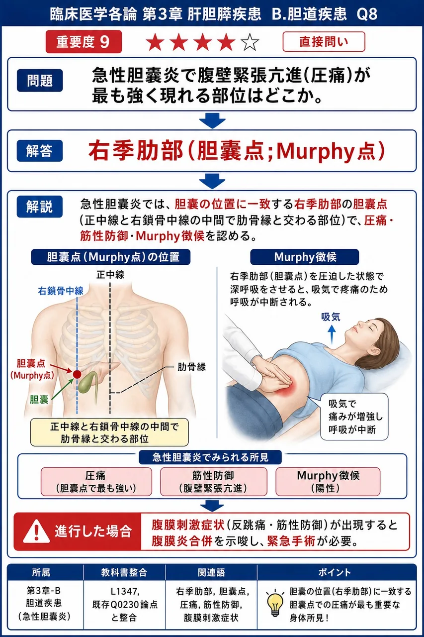 急性胆嚢炎で腹壁緊張亢進(圧痛)が最も強く現れる部位はどこか。 解説図