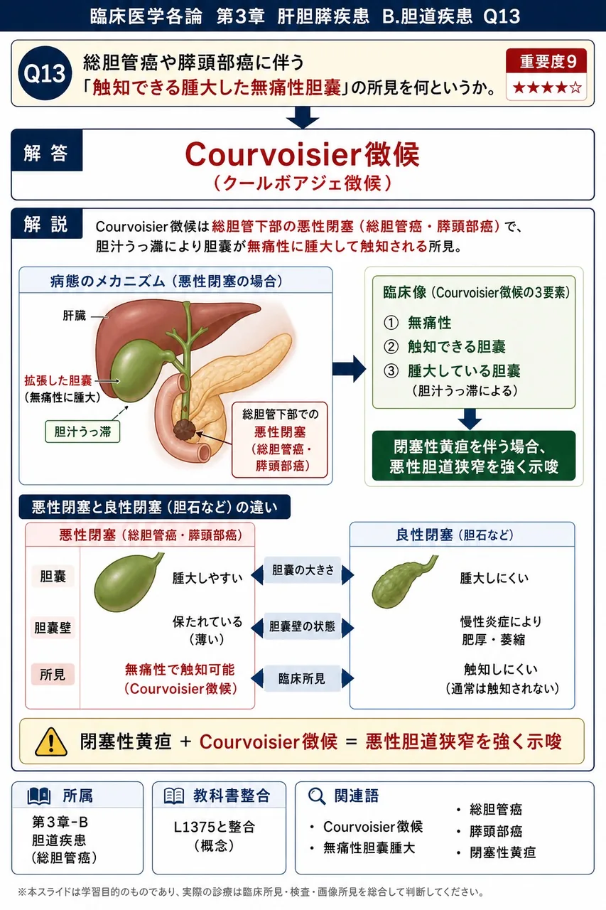 総胆管癌や膵頭部癌に伴う「触知できる腫大した無痛性胆嚢」の所見を何というか。 解説図