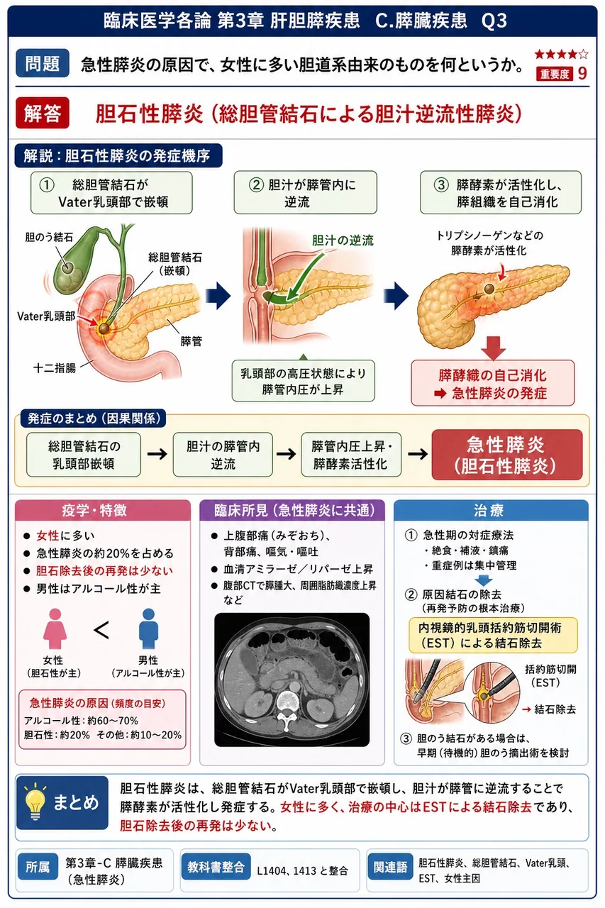 急性膵炎の原因で、女性に多い胆道系由来のものを何というか。 解説図