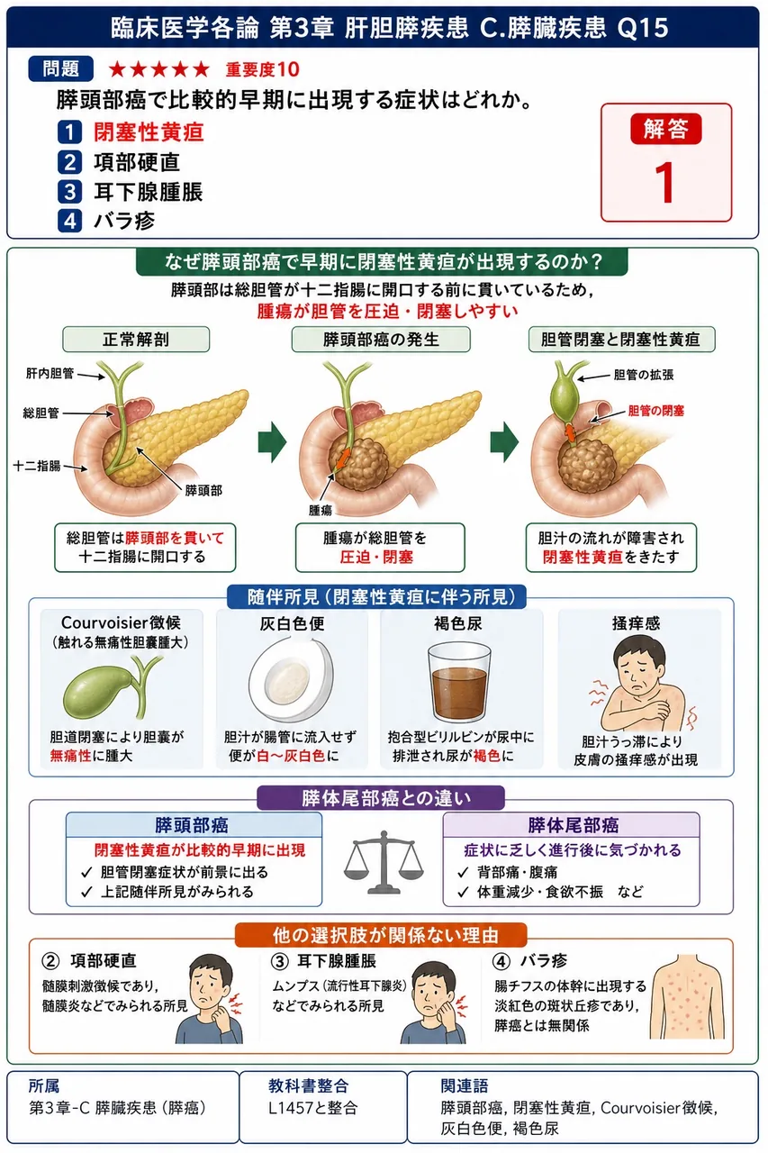 膵頭部癌で比較的早期に出現する症状はどれか。 解説図