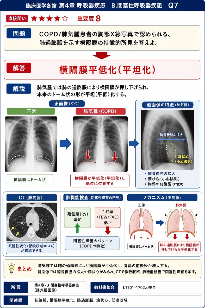 COPD/肺気腫患者の胸部X線写真で認められる、肺過膨脹を示す横隔膜の特徴的所見を答えよ。 解説図