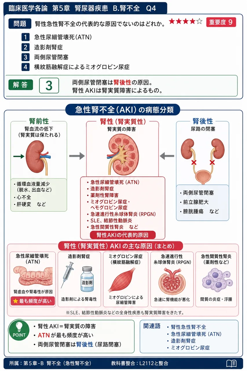 腎性急性腎不全の代表的な原因でないのはどれか。 解説図