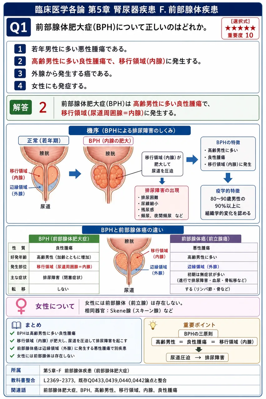 前立腺肥大症(BPH)について正しいのはどれか。 解説図