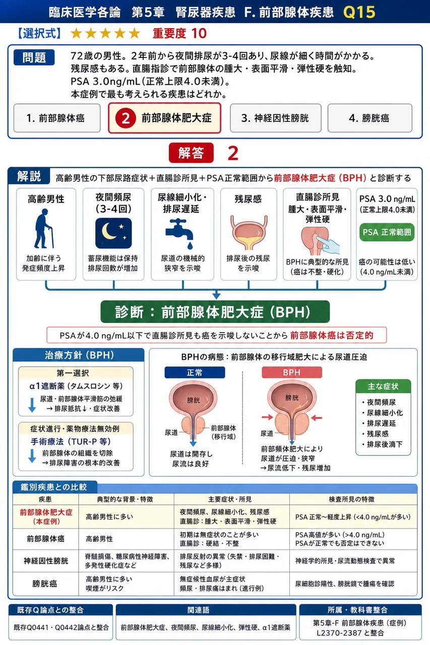 「72歳の男性。2年前から夜間排尿が3-4回あり、尿線が細く時間がかかる。残尿感もある。直腸指診で前立腺の腫大・表面平滑・弾性硬を触知。PSA 3.0ng/mL(正常上限4.0未満)。」本症例で最も考えられる疾患はどれか。 解説図