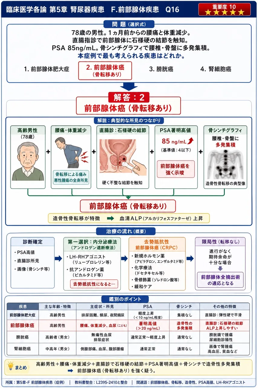 「78歳の男性。1ヵ月前からの腰痛と体重減少。直腸指診で前立腺に石様硬の結節を触知。PSA 85ng/mL。骨シンチグラフィで腰椎・骨盤に多発集積。」本症例で最も考えられる疾患はどれか。 解説図