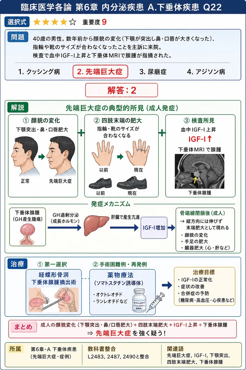 次の患者で最も疑われる疾患はどれか。 「40歳の男性。数年前から顔貌の変化(下顎が突出し鼻・口唇が大きくなった)、指輪や靴のサイズが合わなくなったことを主訴に来院。検査で血中IGF-I上昇と下垂体MRIで腺腫が指摘された。」 解説図