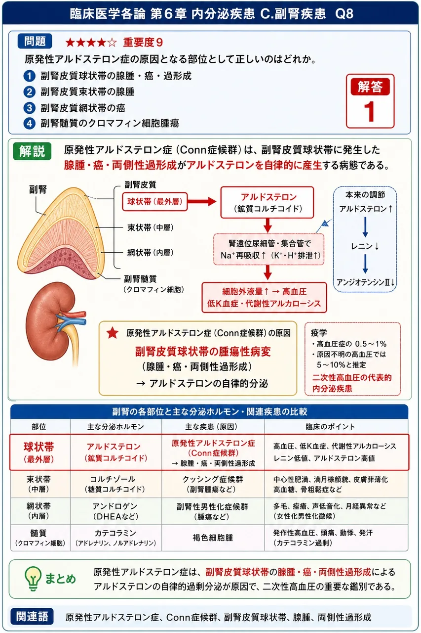 原発性アルドステロン症の原因となる部位として正しいのはどれか。 解説図