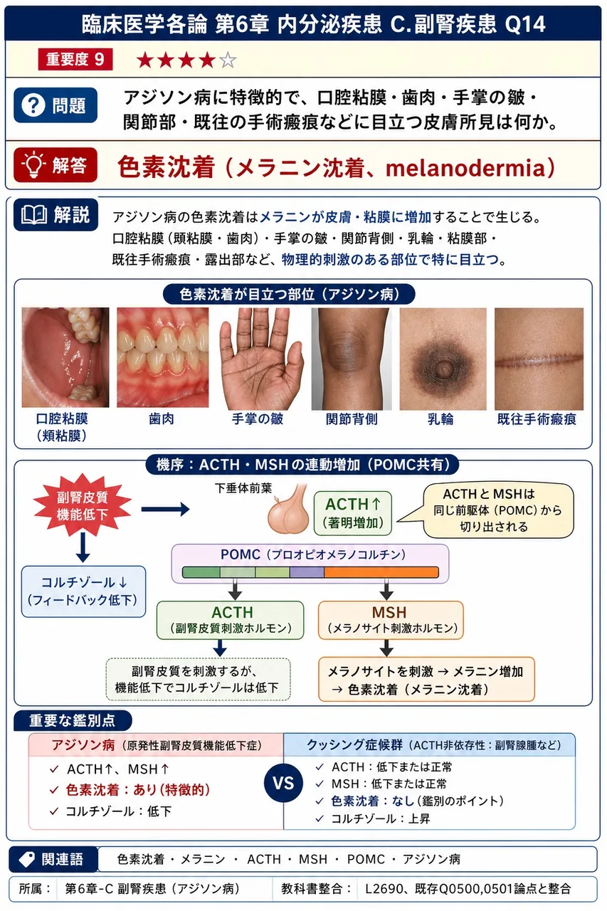 アジソン病に特徴的で、口腔粘膜・歯肉・手掌の皺・関節部・既往の手術瘢痕などに目立つ皮膚所見は何か。 解説図
