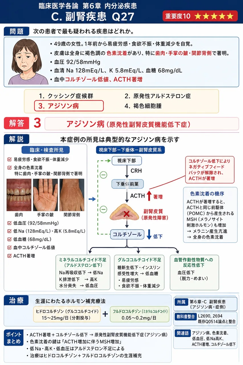 次の患者で最も疑われる疾患はどれか。 「49歳の女性。1年前から易疲労感・食欲不振・体重減少を自覚。皮膚は全身に褐色調の色素沈着があり、特に歯肉・手掌の皺・関節背側で著明。血圧92/58mmHg、血清Na 128mEq/L、K 5.8mEq/L、血糖68mg/dL。血中コルチゾール低値、ACTH著増。」 解説図