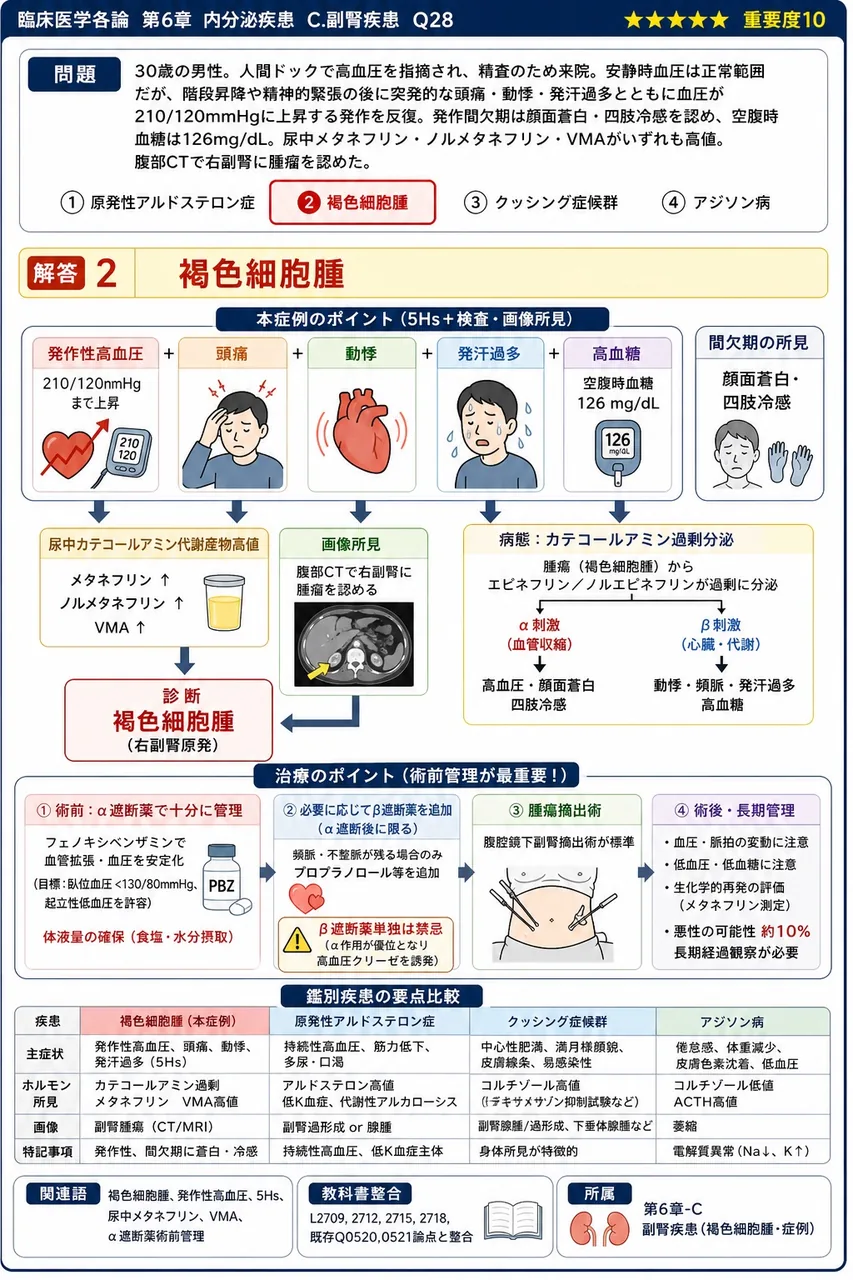 次の患者で最も疑われる疾患はどれか。 「30歳の男性。人間ドックで高血圧を指摘され、精査のため来院。安静時血圧は正常範囲だが、階段昇降や精神的緊張の後に突発的な頭痛・動悸・発汗過多とともに血圧が210/120mmHgに上昇する発作を反復。発作間欠期は顔面蒼白・四肢冷感を認め、空腹時血糖は126mg/dL。尿中メタネフリン・ノルメタネフリン・VMAがいずれも高値。腹部CTで右副腎に腫瘤を認めた。」 解説図