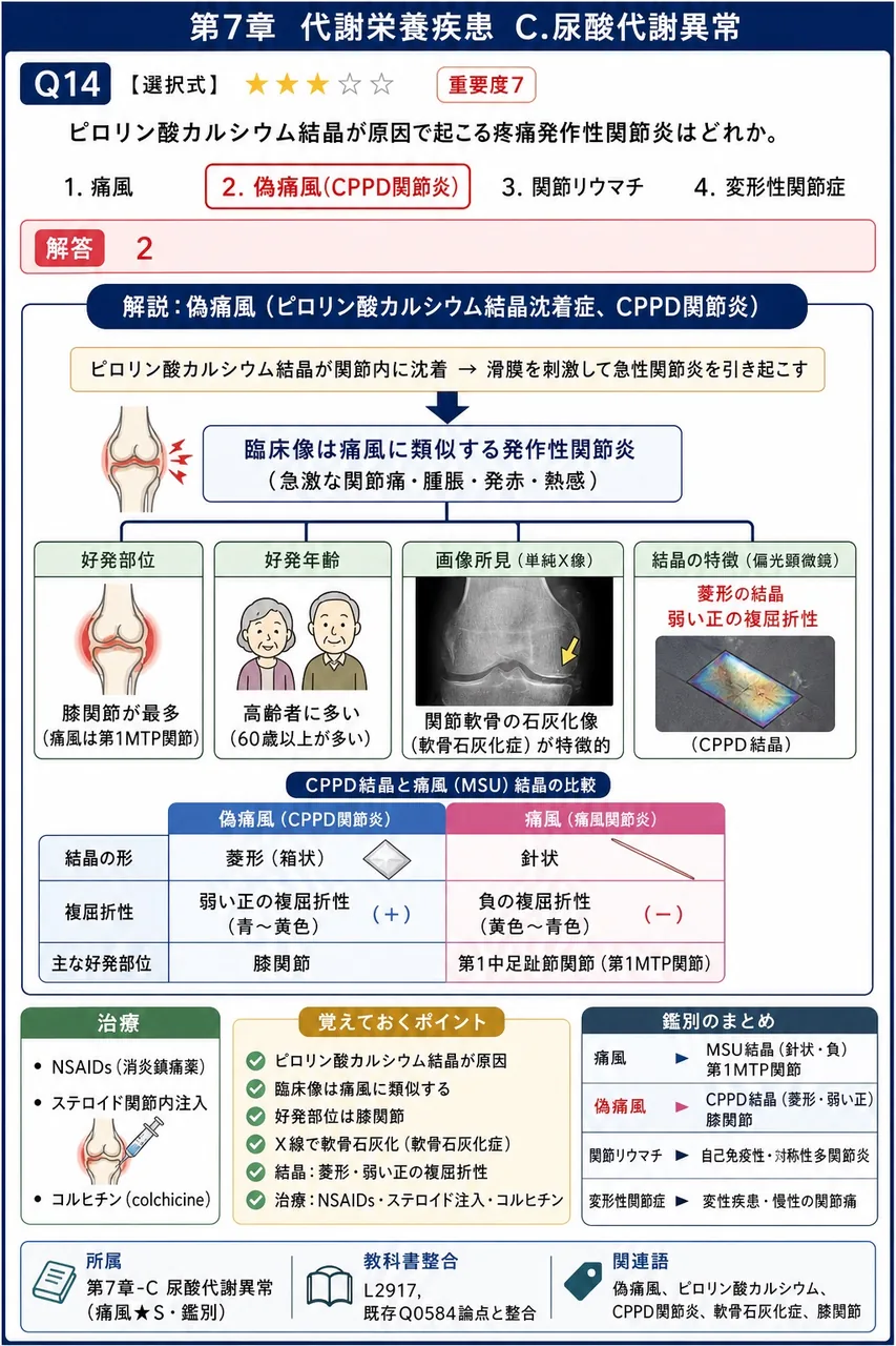 ピロリン酸カルシウム結晶が原因で起こる疼痛発作性関節炎はどれか。 解説図