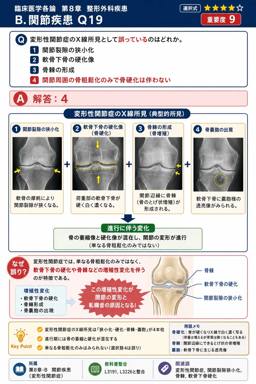 変形性関節症のX線所見として誤っているのはどれか。 解説図