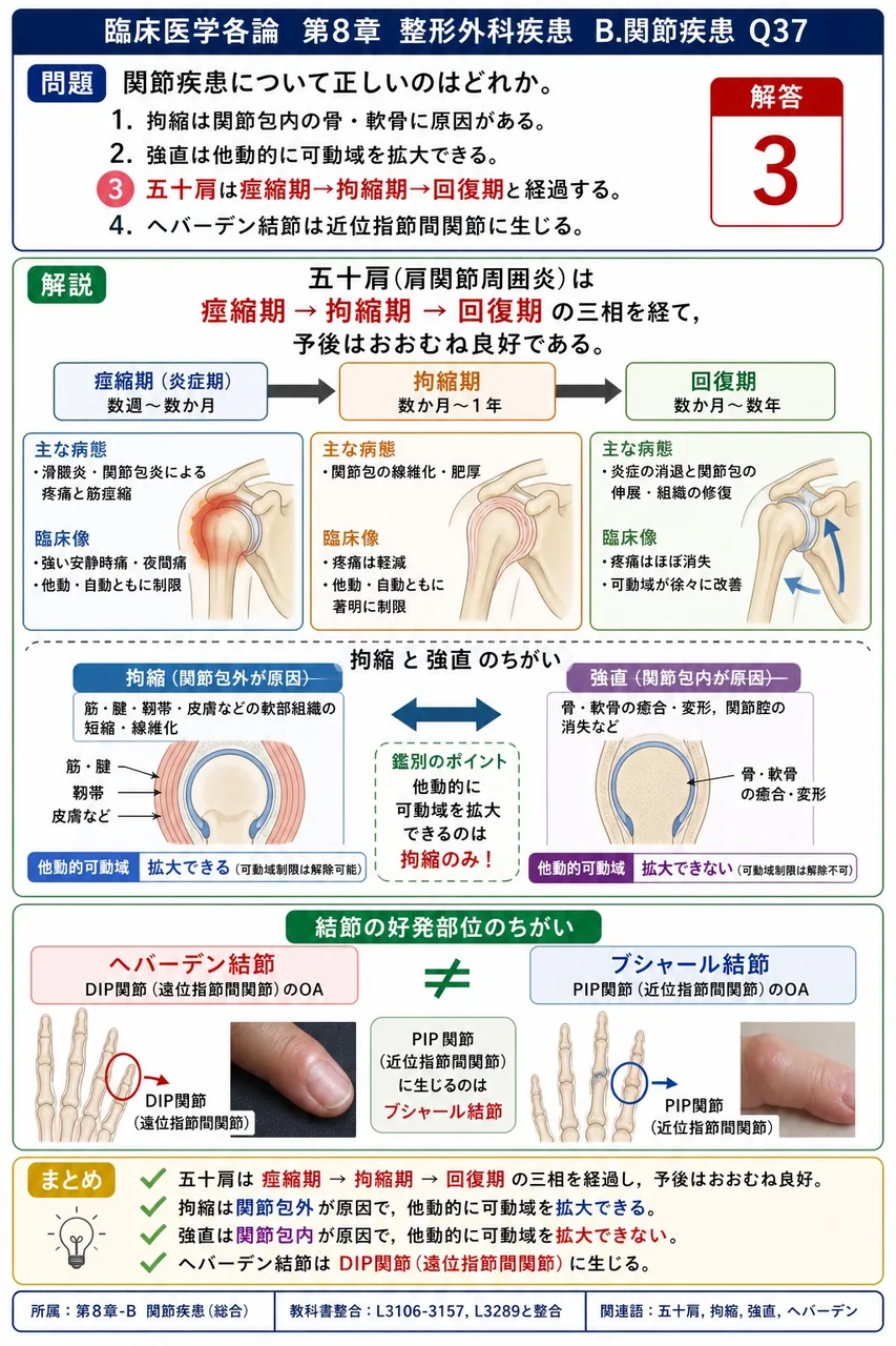 関節疾患について正しいのはどれか。 解説図