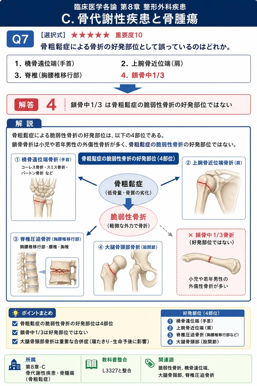 骨粗鬆症による骨折の好発部位として誤っているのはどれか。 解説図
