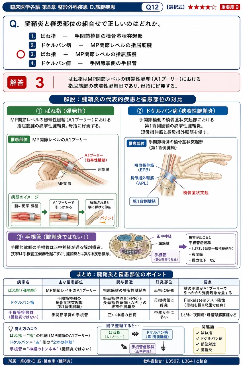 腱鞘炎と罹患部位の組合せで正しいのはどれか。 解説図