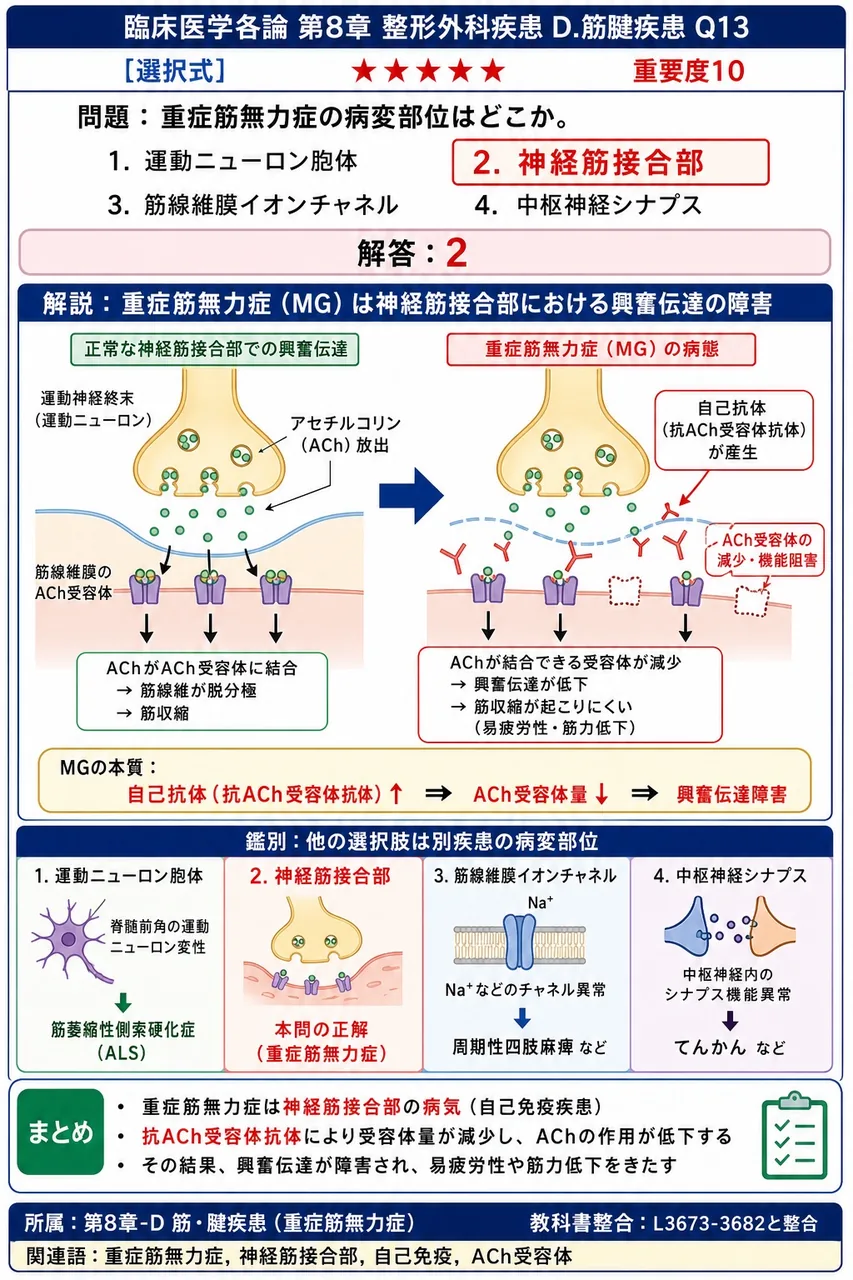 重症筋無力症の病変部位はどこか。 解説図