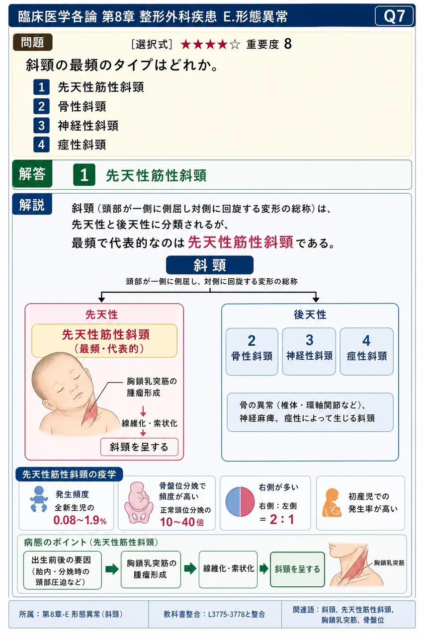斜頸の最頻のタイプはどれか。 解説図