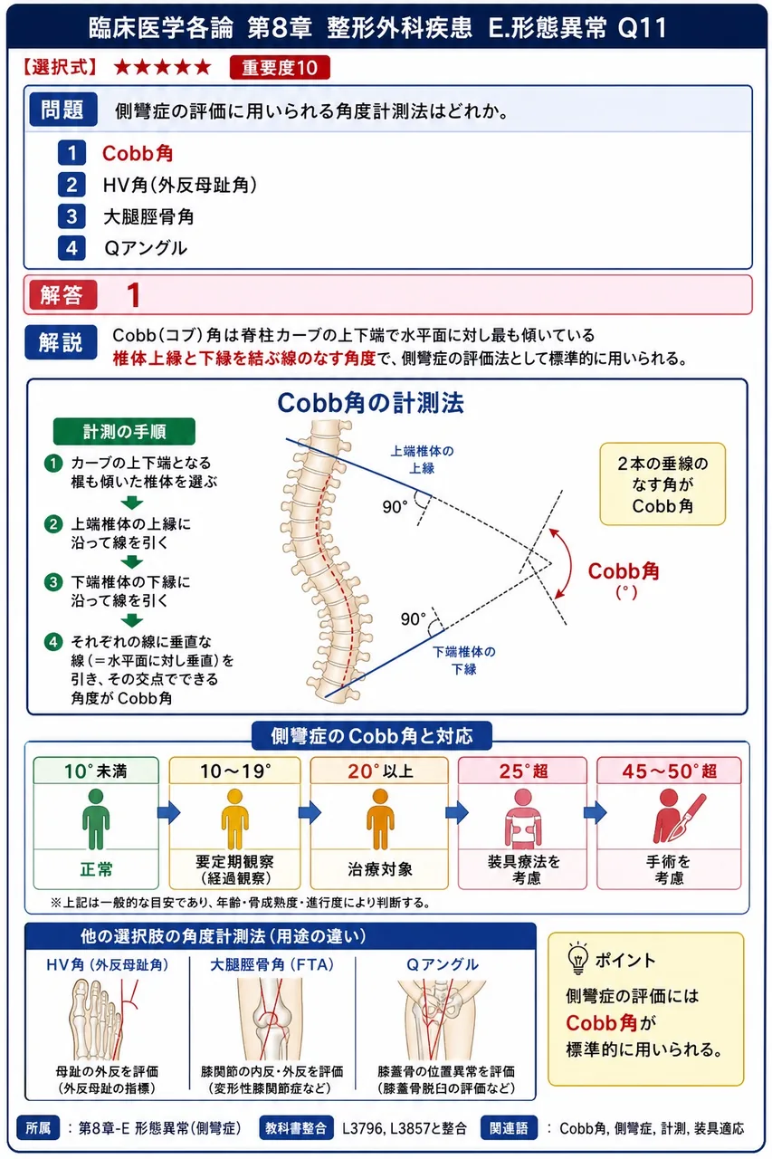 側彎症の評価に用いられる角度計測法はどれか。 解説図