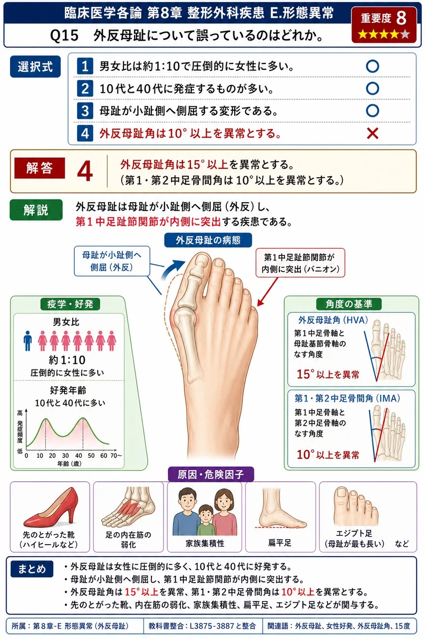 外反母趾について誤っているのはどれか。 解説図
