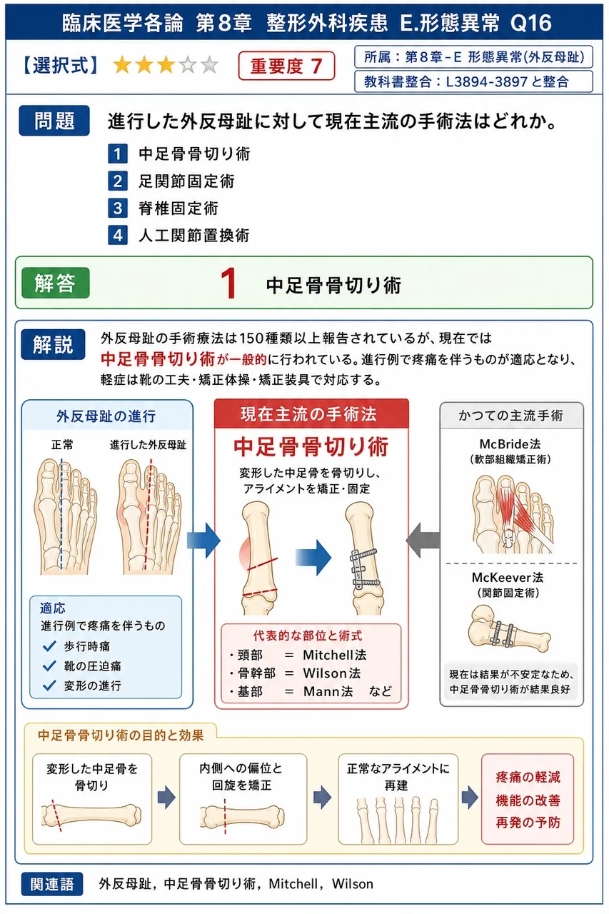 進行した外反母趾に対して現在主流の手術法はどれか。 解説図