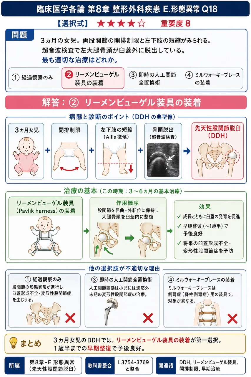 「3ヵ月の女児。両股関節の開排制限と左下肢の短縮がみられる。超音波検査で左大腿骨頭が臼蓋外に脱出している。」最も適切な治療はどれか。 解説図