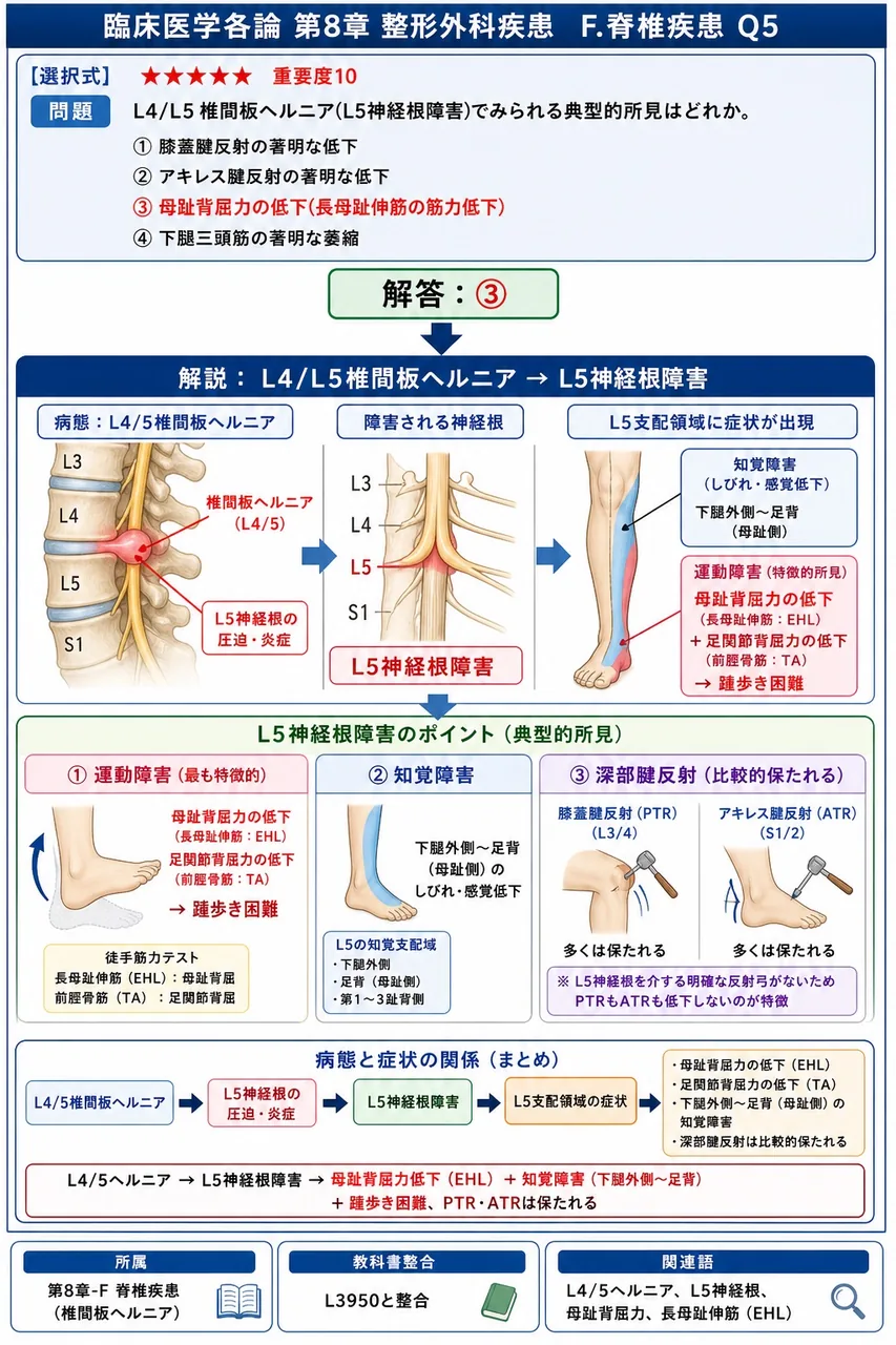 L4/L5椎間板ヘルニア(L5神経根障害)でみられる典型的所見はどれか。 解説図