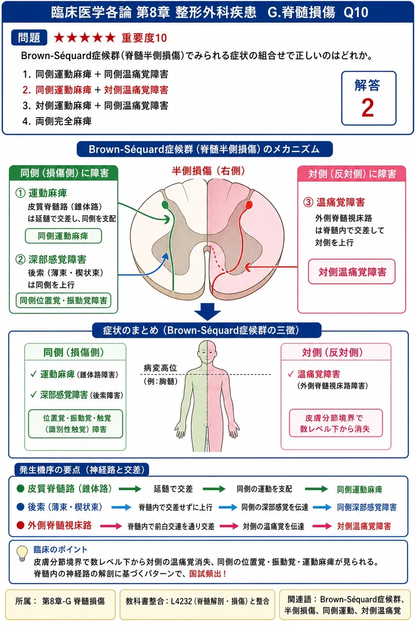 Brown-Séquard症候群(脊髄半側損傷)でみられる症状の組合せで正しいのはどれか。 解説図